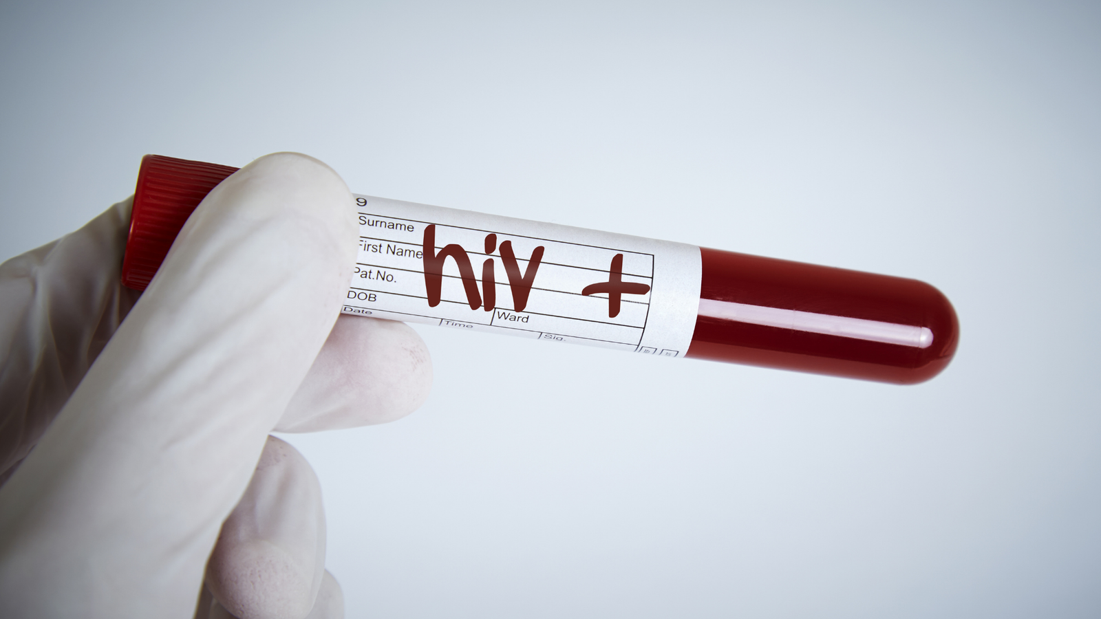 Isenção de Imposto de Renda para Pessoas com HIV Positivo: Um Direito que vai Além dos Sintomas