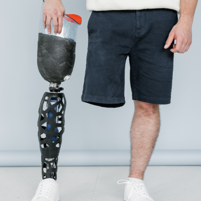 Próteses e Órteses pelo Plano de Saúde: Por que Cobre um Stent, mas não um Óculos?